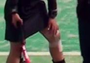 Injured Knee